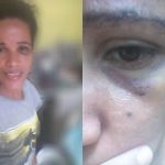 Babá ganduense, uma das vítimas de agressões por ex-patroa em Salvador fala ao Repórter Bahia