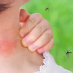 Em caso de virose ou sintomas de dengue e zika vírus, posto de saúde do bairro é a primeira opção recomendada